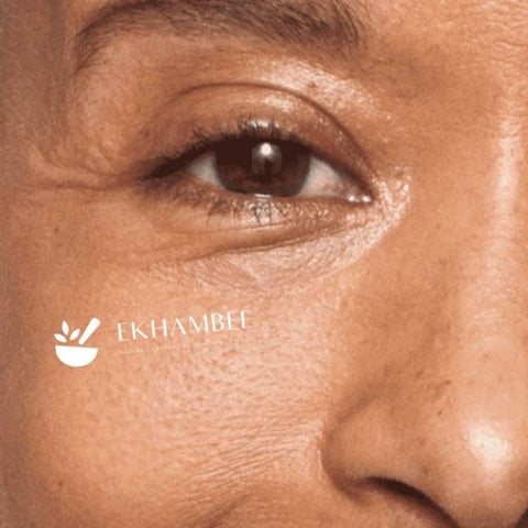 Women with eye wrinkles abd fine lines on cheek