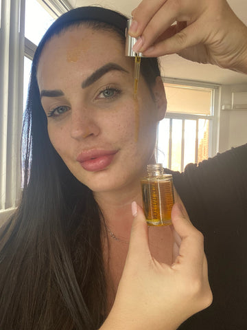 Woman using facial oil as part of her skincare for dry dehydrated skin.