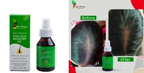 Follicle Booster by Raw African Before & After Results on ZYNAH Egypt