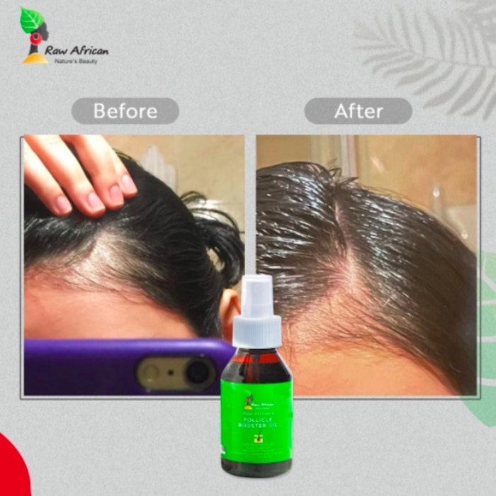 Follicle Booster Hair Oil by Raw African - before and after - shop on ...