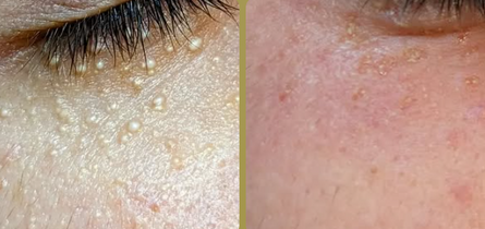ApisHeal_VenomBoost_Collagen_Eye (5) (1).png__PID:e4062c05-e654-4b7e-a285-3c43fdb234f7