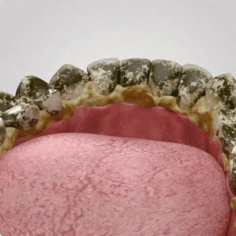 GIF 02.gif__PID:27ee0e91-6f45-424a-8edb-8d144435386d