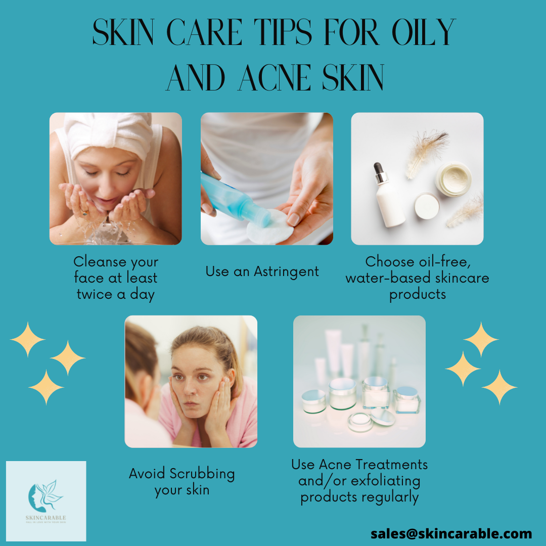 Skin Care Tips for Oily and Acne Skin Image