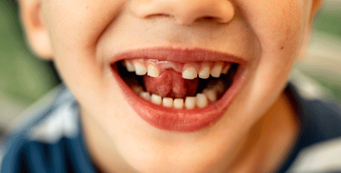 First lost tooth blog by 20 Moments of Tooth