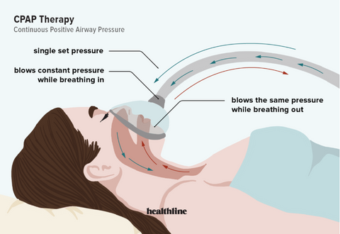 CPAP Machine