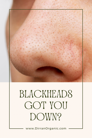 Blackheads Got You Down?