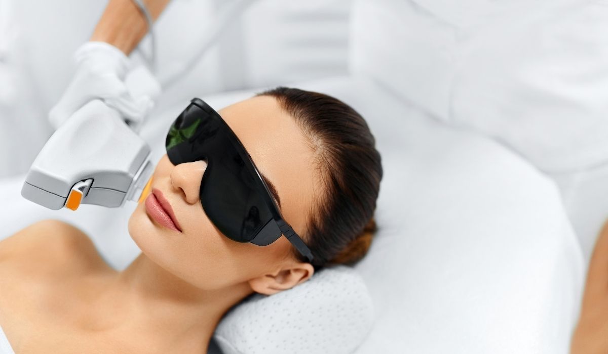 IPL photofacial treatment