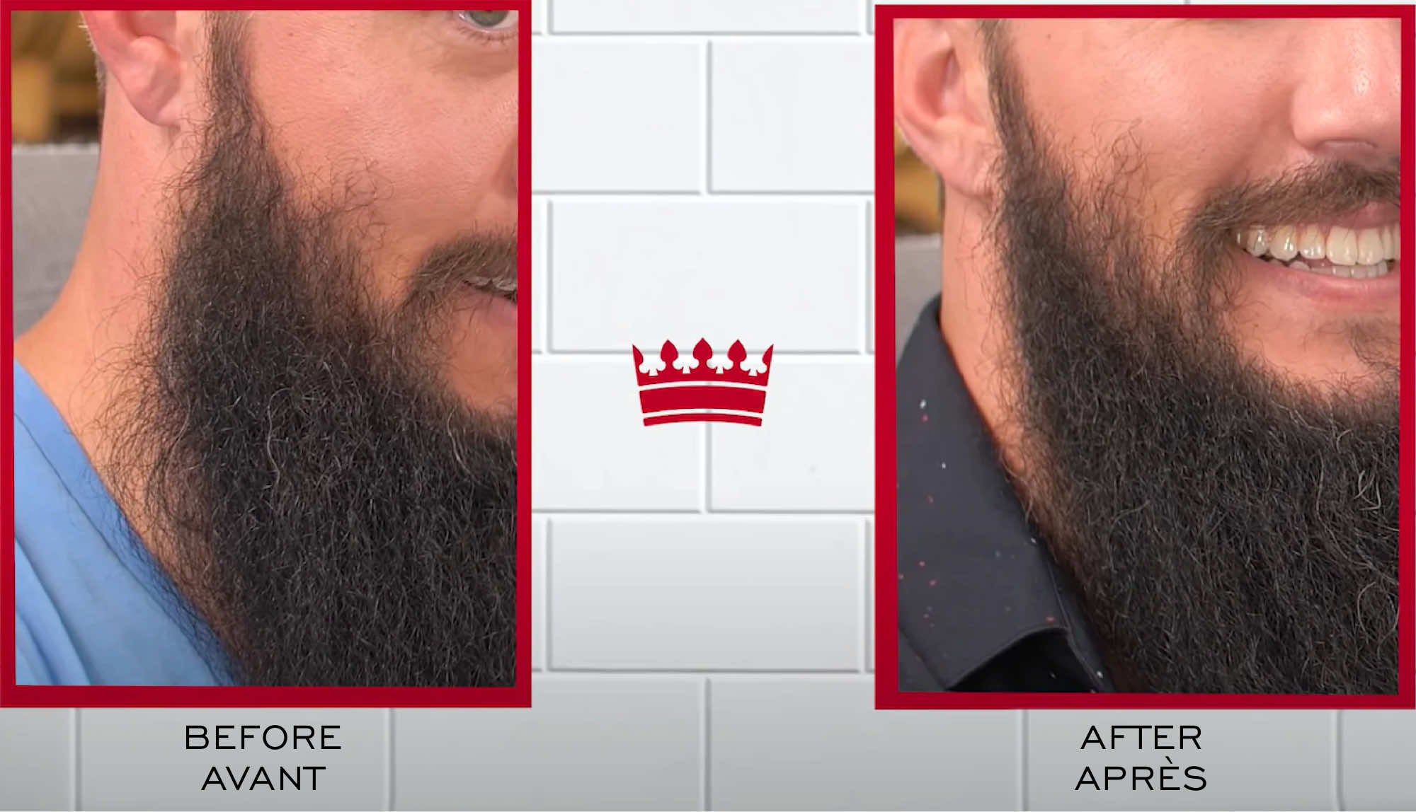 Patchy beard before and after chin close up