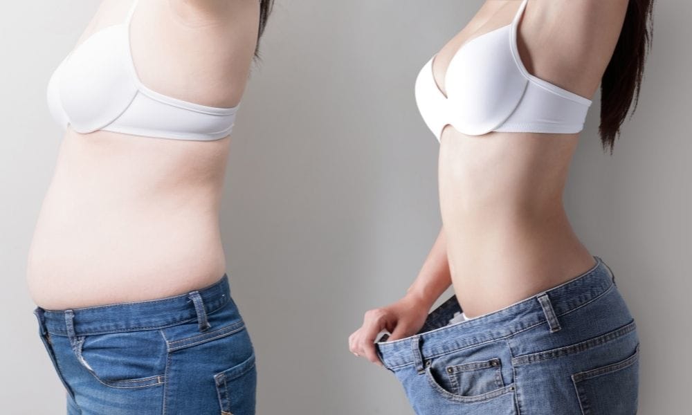 Résultat avant après corset minceur sur une femme