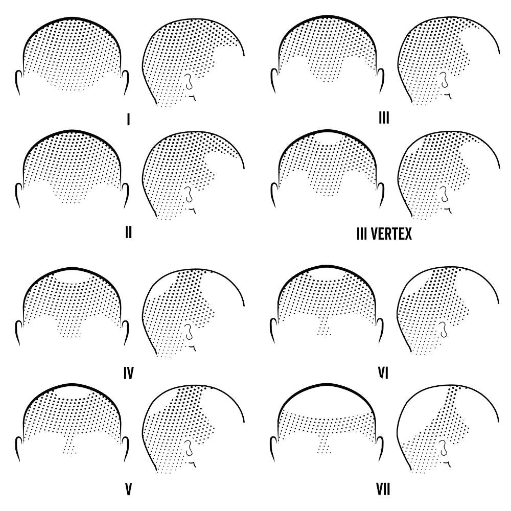 norwood scale 1 to 7 examples