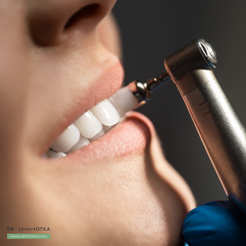Professionelle Mundhygiene kann die Zähne signifikant heller machen
