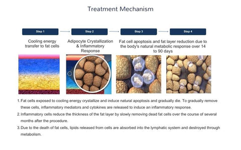 An image that show the Fat Freezing The Cryolipolysis Process