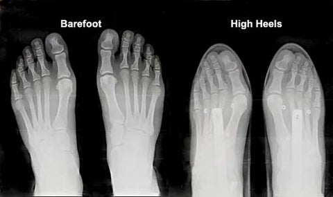 barefoot vs narrow shoes