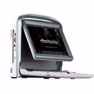 Chison ECO5 Vet Demo Model Color Doppler Ultrasound | KeeboVet Veterinary Ultrasound Equipment