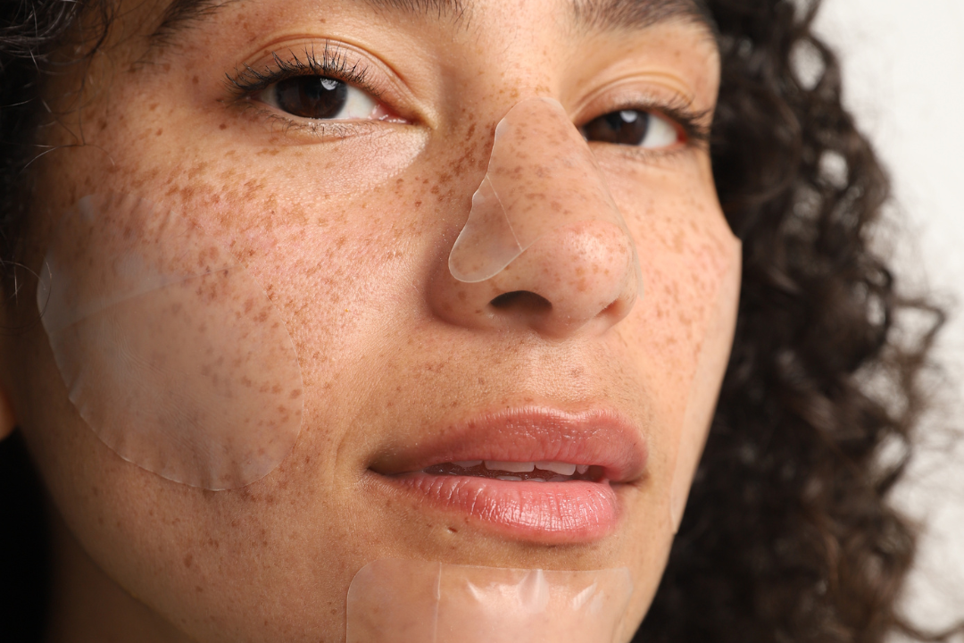 how-long-to-leave-pimple-patches-on-and-what-to-do-after-removing-them