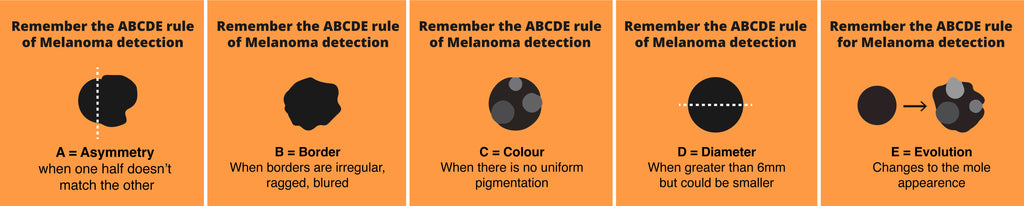 ABCDE rule of Melanoma