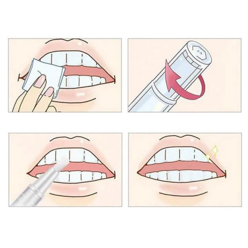 VIMEDA | Teeth Whitening Pen™ (1+1 GRATIS)