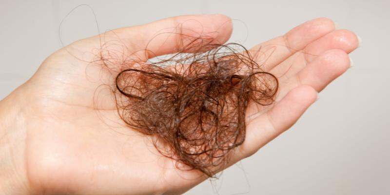 hair loss from medical conditions