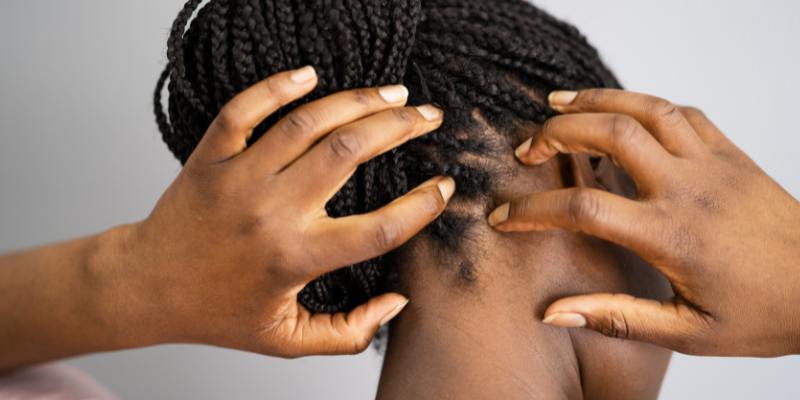 itchy scalp black woman