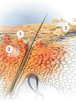 Arising Eczema