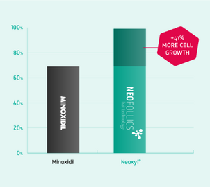 Minoxidil vs Neoxyl.png__PID:02f2d70a-aff0-4f35-8ad4-f8ddbf006c55