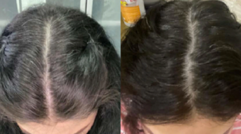 Voor en na de resultaten van grijs haar