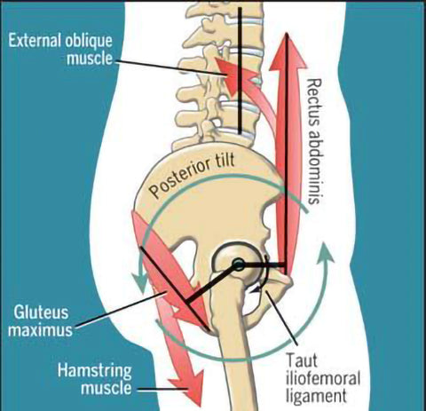 Diagram of the human lower back illustrating lumbo-pelvic-hip complex (LPHC) movements.