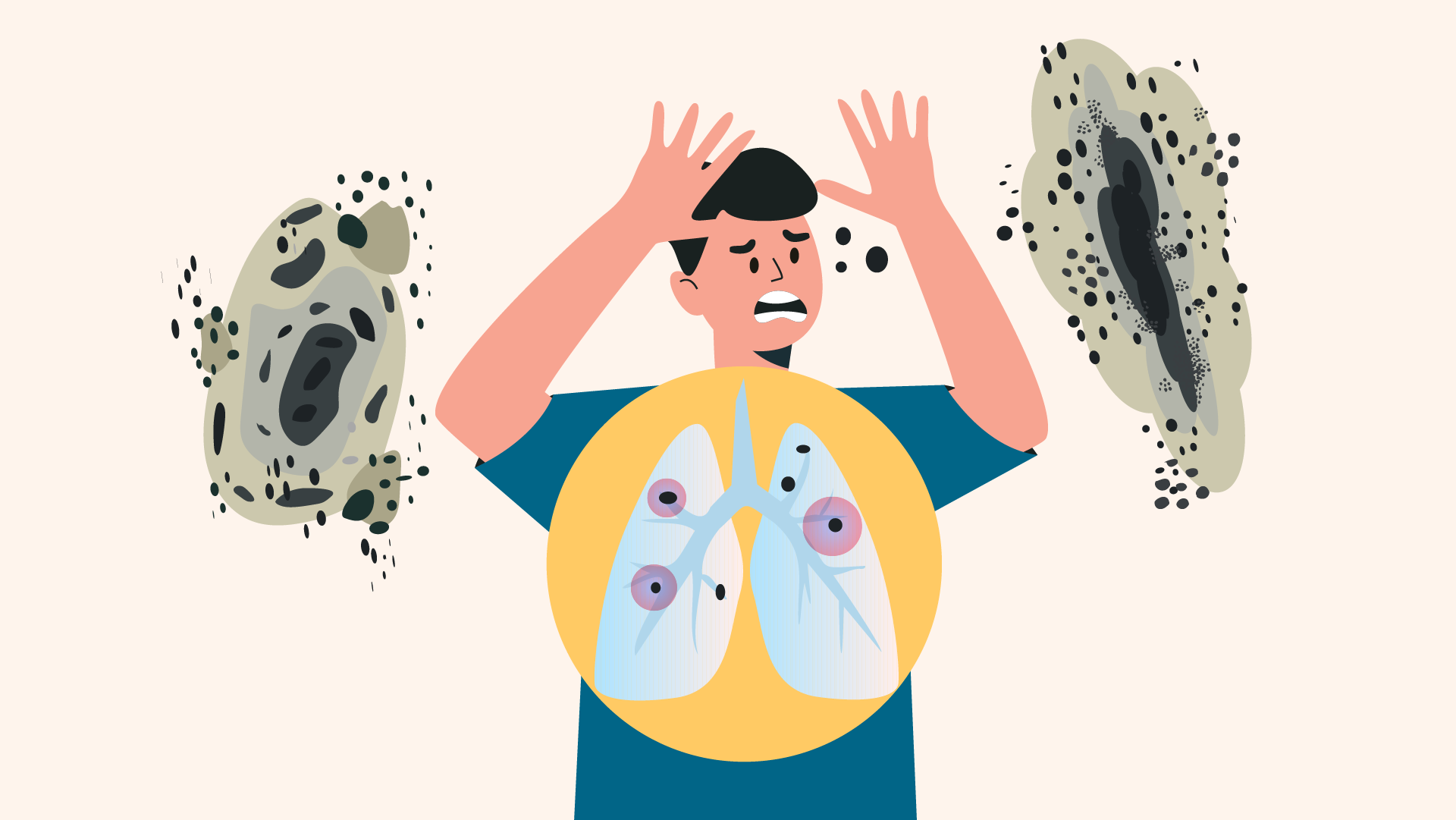 Illustrazione di una persona che respira visualizzando in modo evidente le muffe e spore che arrivano ai polmoni. Questa rappresentazione aiuta a comprendere i possibili problemi per problemi legati all'asma
