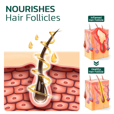 HairVive™ Scalp Folliculitis Therapy තෙල්