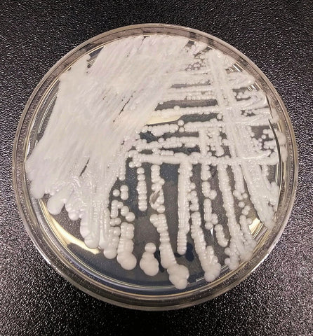 A petri dish containing Candida auris culture in a CDC laboratory, reflecting the critical research in combatting this global health threat.