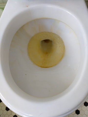 toilet bowl with yellow stain in center