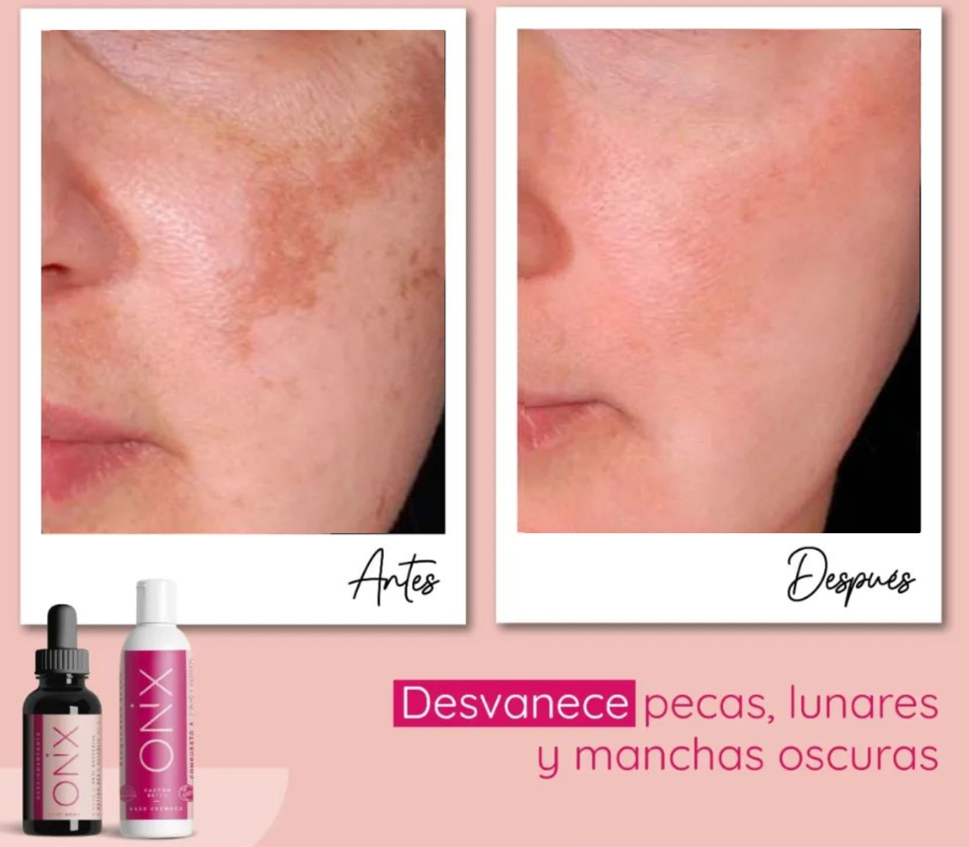 Cómo Aclarar la piel Quemada Por el Sol? – Mechaz Beauty