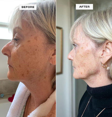 Jane-before-and-after-using-red-algae