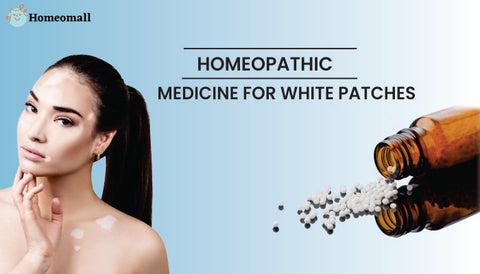 Homeopathic Medicine for White Patches 