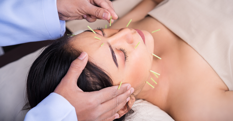 Face Acupuncture_B-healthy