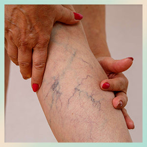 compression stockings