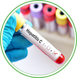 Indication_Hepatitis