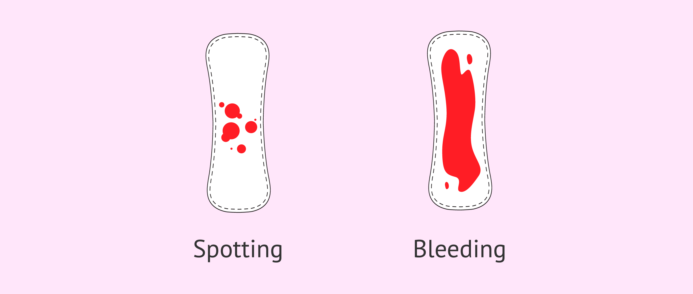 What You Need To Know About Bleeding During Pregnancy Bmama Maternity