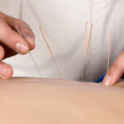 acupuncture energy healing