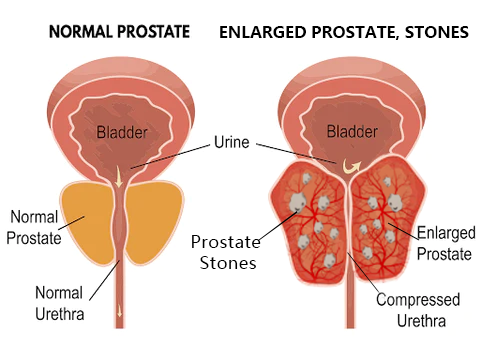 FemiPure™ Prostate Gel