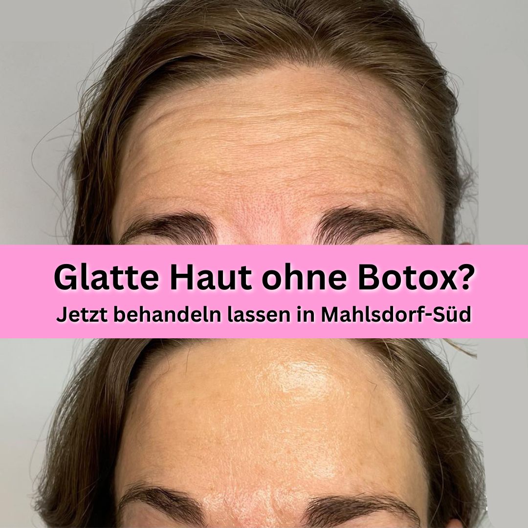 Glatte Haut ohne Botox.jpg__PID:4f0f8404-c776-4d58-a61b-78e87f0bd201