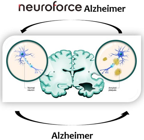 reverse alzheimer fight cure natural