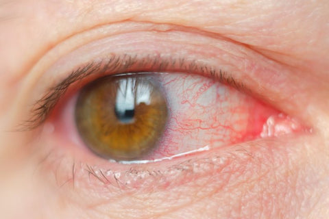 eye disease can cause your eyes to sting