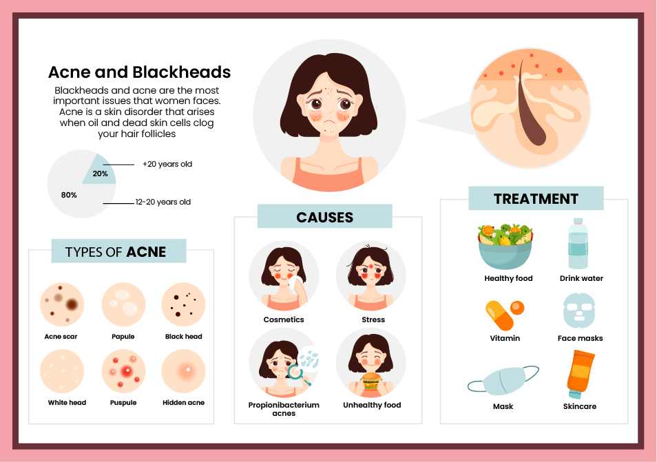 types of acnes, causes and their treatment