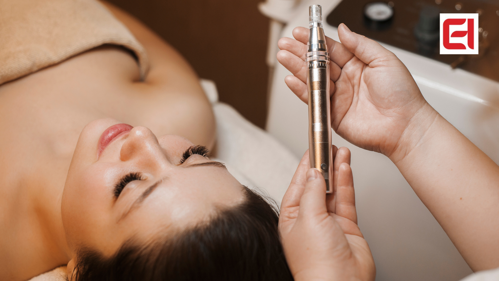 microneedling