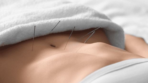 Acupuncture la maladie de Crohn Natura Force