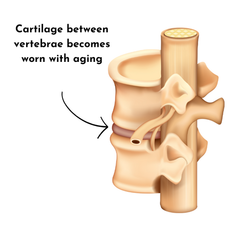 cartilage between vertebrae