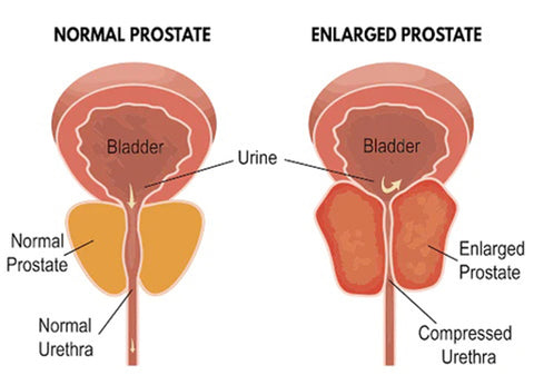 CC™ Prostate Health Herbal Capsules