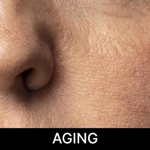 AGING and Fine Lines