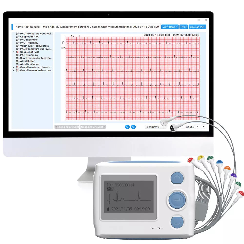 24 HOURS AI ECG HOLTER Wellue 12 Lead ECG Holter Monitor